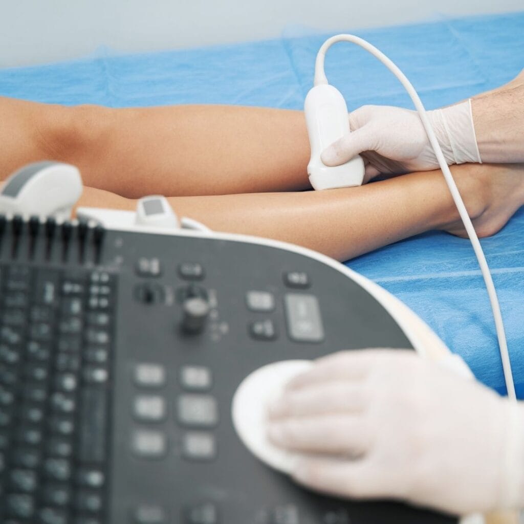 Lekarz wykonujący badanie USG Doppler kończyny dolnej w diagnostyce żylaków.