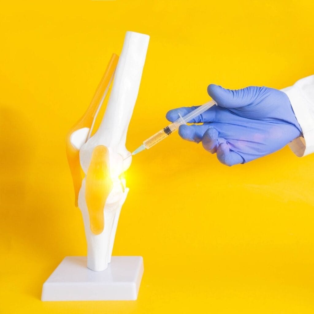 Zdjęcie przedstawia procedurę podania sterydu do jamy stawowej (przeciwbólowo).