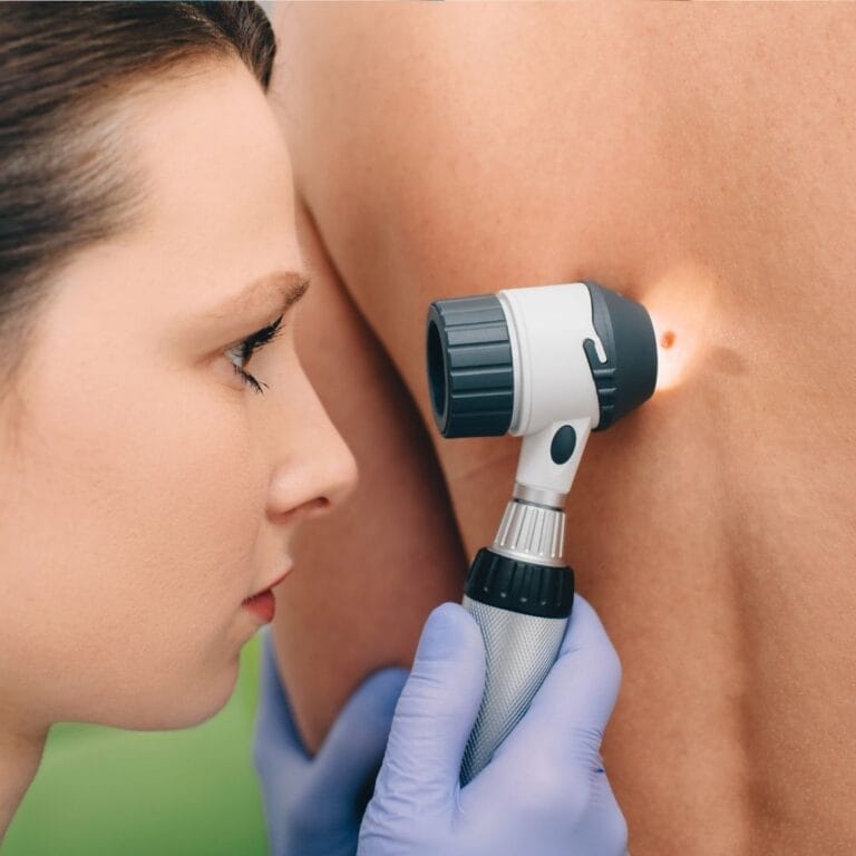 Zdjęcie przedstawia lekarkę dermatolog wykonującą badanie dermatoskopii zmiany skórnej na plecach pacjenta.